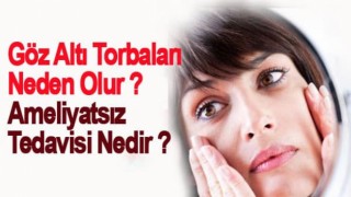 Göz Altı Torbaları Neden Olur ? Ameliyatsız Tedavisi Nedir ?