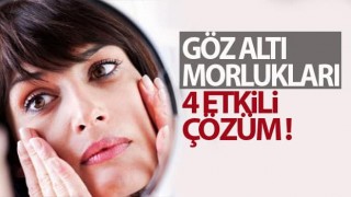 Göz Altı Morlukları 4 Etkili Çözüm !