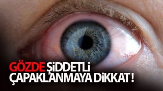 Gözde Şiddetli Çapaklanmaya Dikkat!