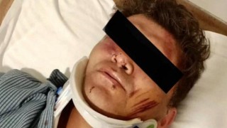 Sağlıkta şiddette geldiğimiz yer, sopalarla sokakta doktor dövmek